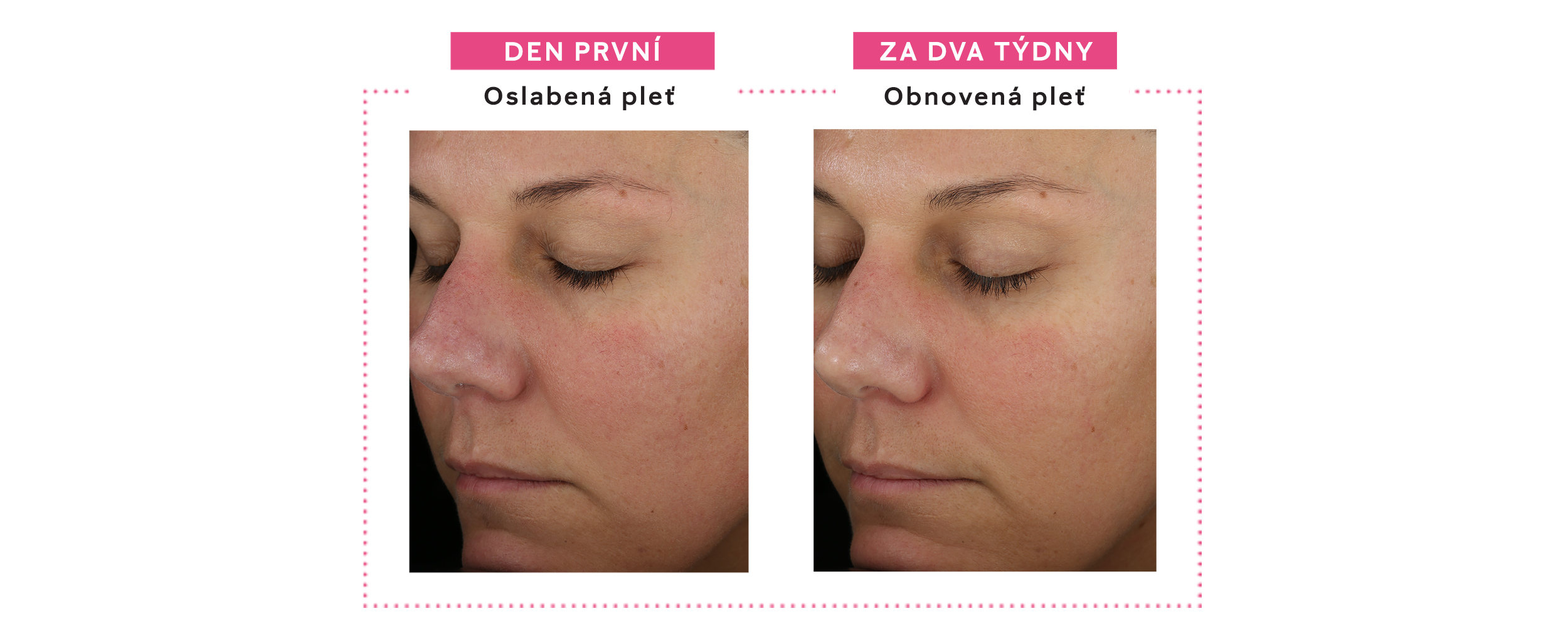 Krém na ochranu kožní bariéry před a po